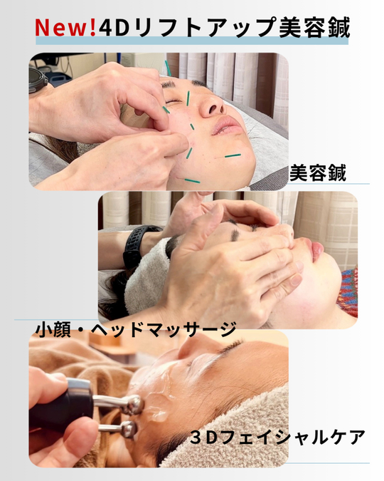 進化した自然派『4Dリフトアップ美容鍼』八王子の大人エイジングケア